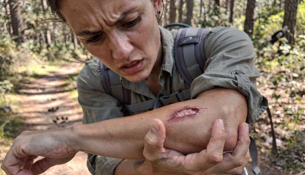 Premiers secours en cas de morsure ou griffure d'un animal sauvage